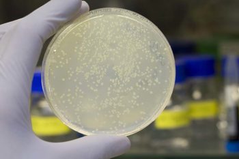 A petri dish with bacteria growing in it.